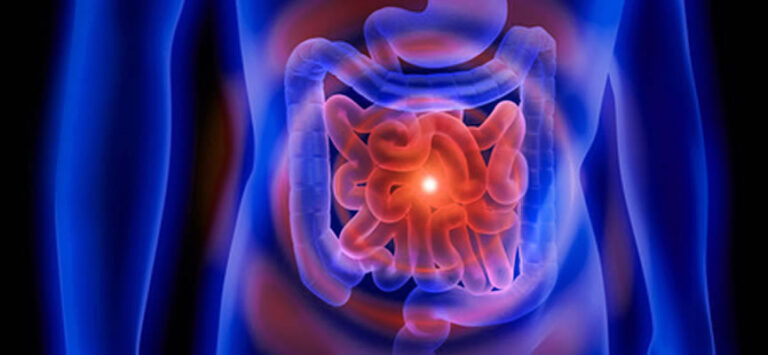 ibd-inflammatory-bowel-disease